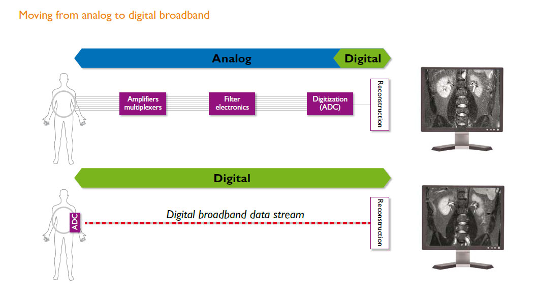 Banda ancha an&aacute;loga a digital dStream