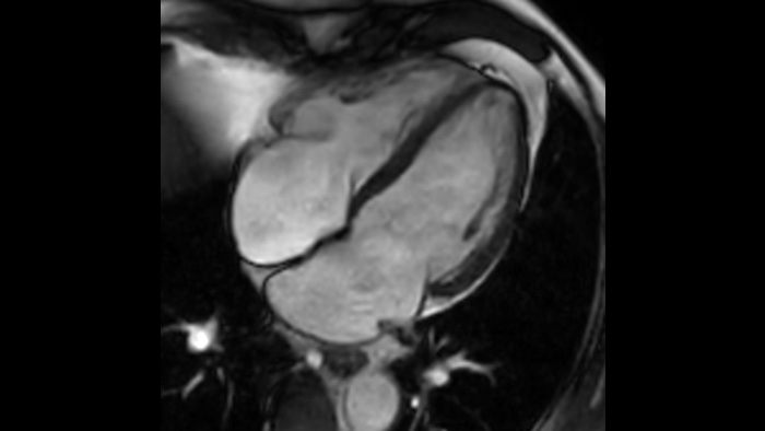 Medio card&iacute;aco