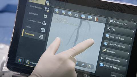 Presentamos la nueva generaci&oacute;nde Philips Azurion para la radiolog&iacute;a intervencionista