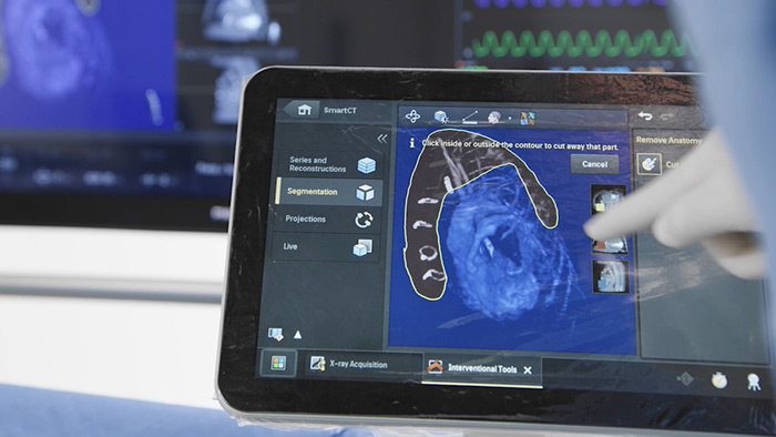 Marque los detalles relevantes en las im&aacute;genes 2D