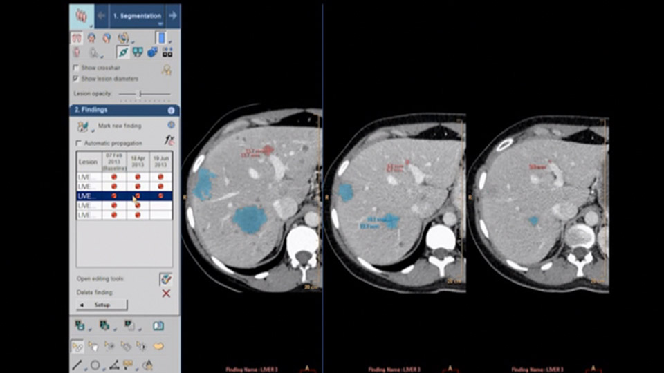 Visualizaci&oacute;n Avanzada