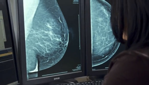 Agilizar la revisi&oacute;n de im&aacute;genes