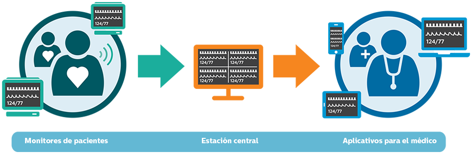 Beneficios de Philips