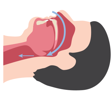 V&iacute;as respiratorias no obstruidas y obstruidas